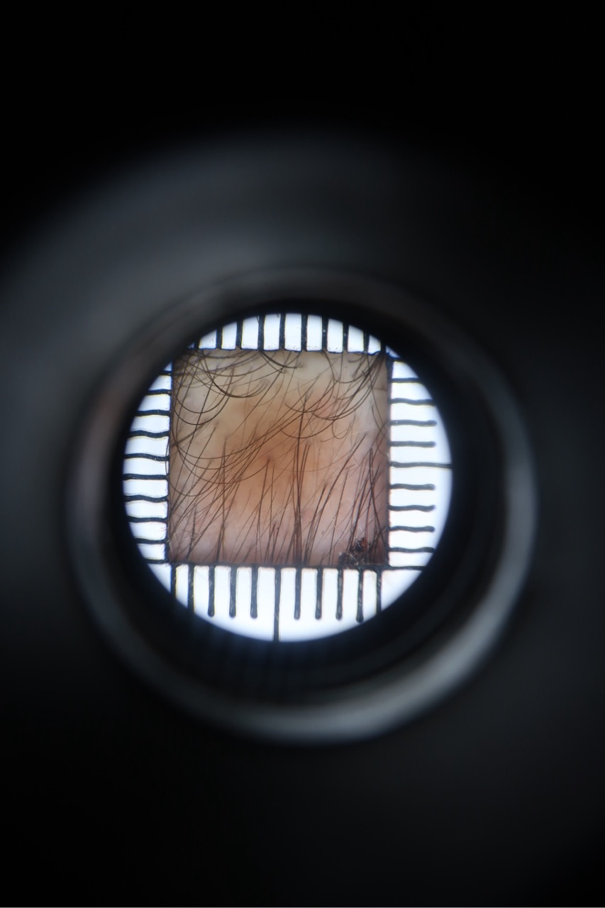 Magnified view of hair growth phases
