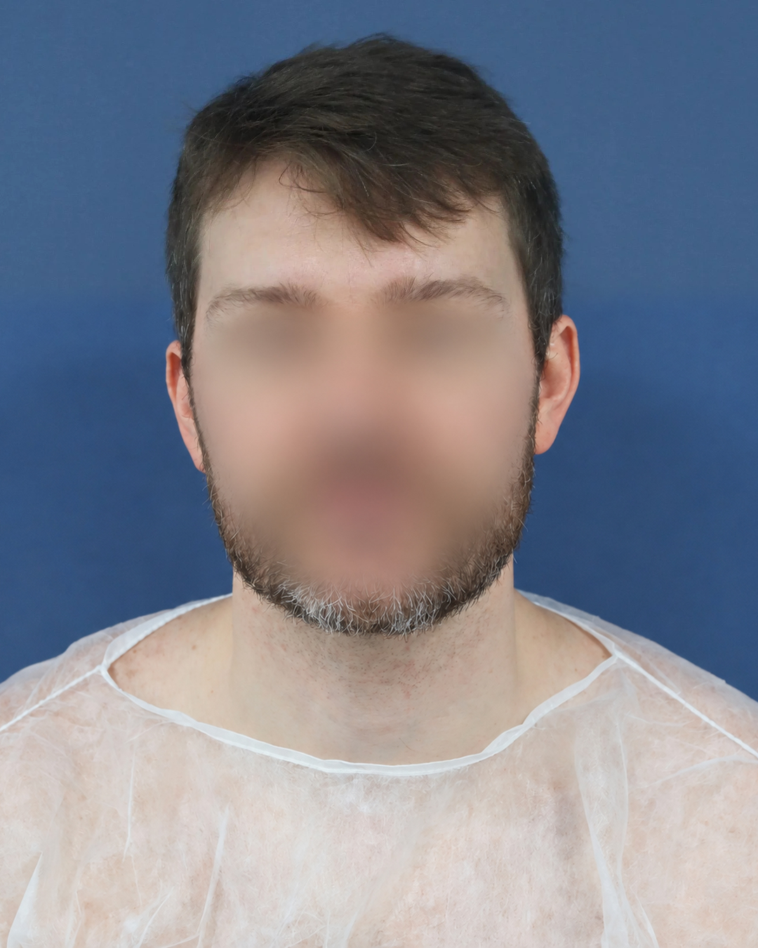 2300-before-face-blurred